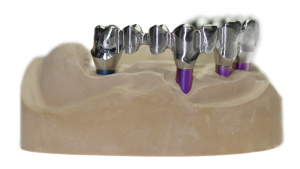 hochwertiges Reintitan