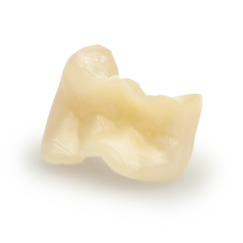 multilayer pritidenta